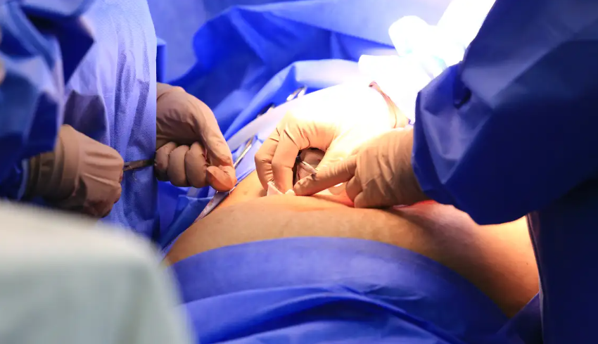  Programa nacional reduz filas cirúrgicas do SUS em cinco Estados 